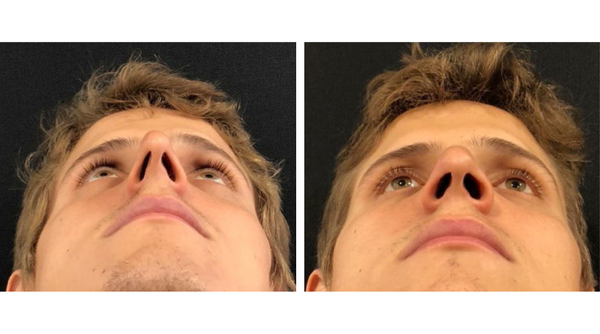 How We Test Our Nose Strips